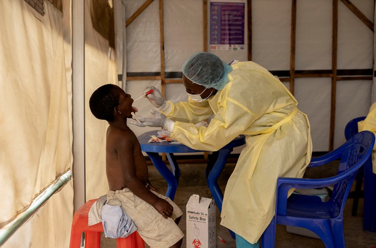 No MONKEYPOX in Zimbabwe- GOVERNMENT